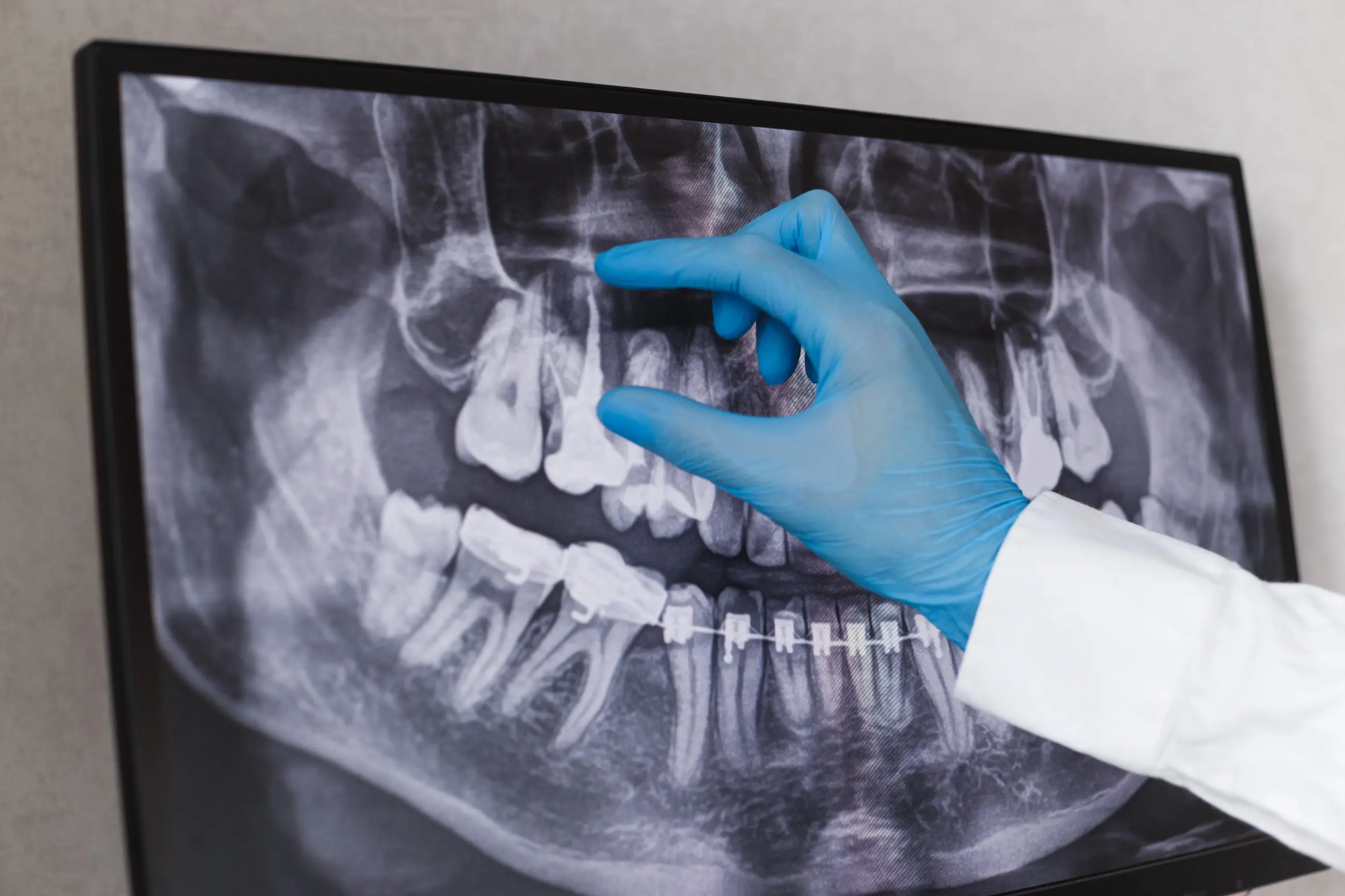 Implantate